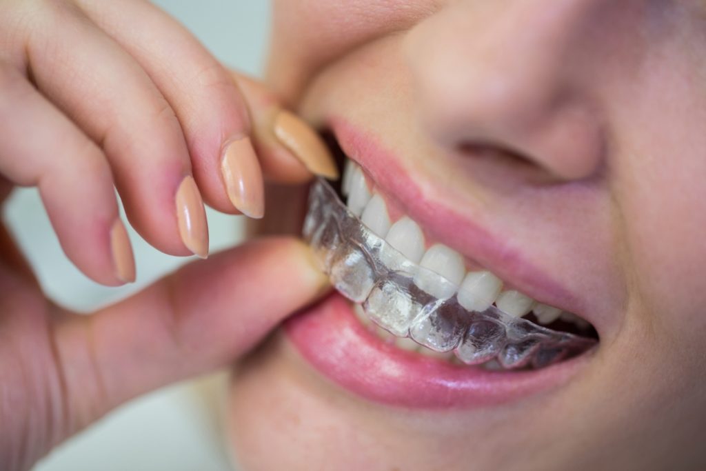 Quand les dentistes deviennent plus forts!