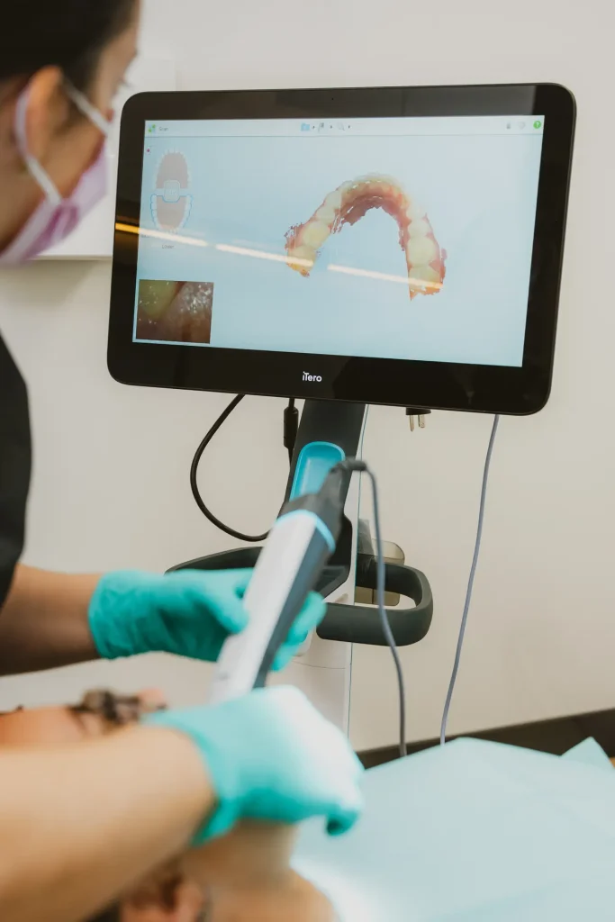 Prise d'empreinte numérique 3D avec scanner iTero au Centre dentaire Boucherville